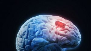 Μελέτη-σοκ: Ένας στους τέσσερις ανθρώπους άνω των 25 ετών κινδυνεύει από εγκεφαλικό