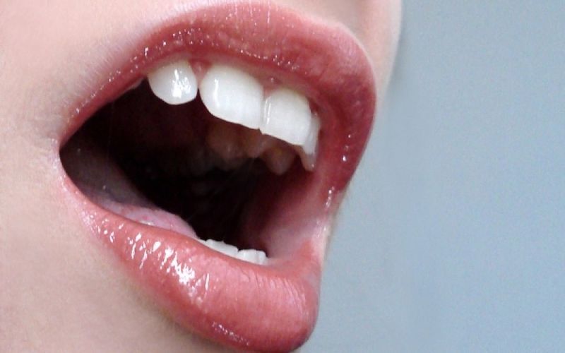 Οκτώ συμπτώματα του στόματος που δεν πρέπει να αγνοήσεις