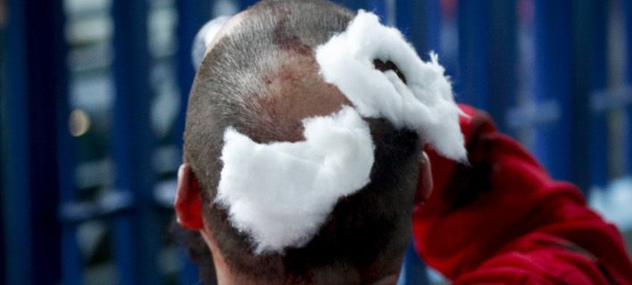 Απίστευτο-«Ντου» με μαχαίρι, κράνη και ρόπαλα σε αγώνα πόλο γυναικών! -Δύο τραυματίες-ΦΩΤΟ