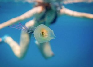 Τι θα κάνετε αν σας τσιμπήσει τσούχτρα