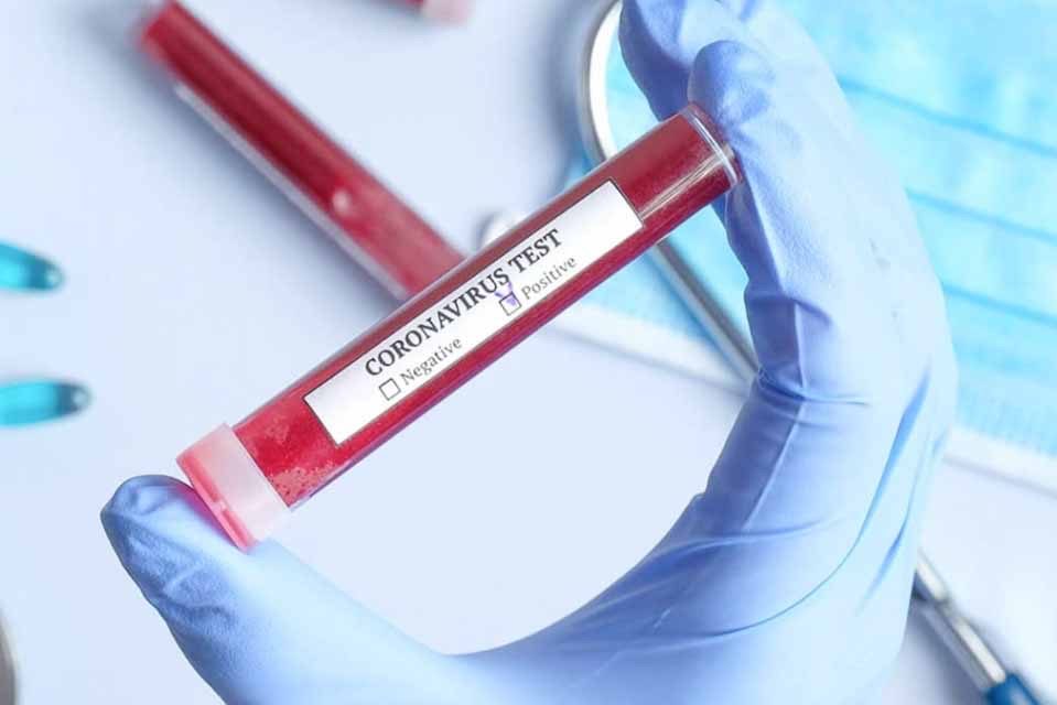 Βρετανία -Κορωνοϊός: Αρχίζουν κλινικές δοκιμές για το εμβόλιο κατά του ιού