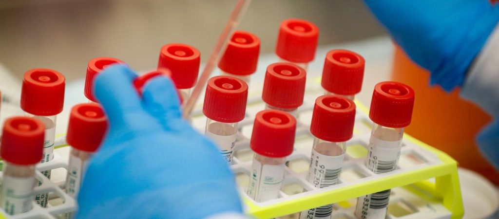 Υπ. Άμυνας Ισραήλ: Εντοπίσαμε αντίσωμα που εξουδετερώνει τον κορωνοϊό Υπ. Άμυνας Ισραήλ: Εντοπίσαμε αντίσωμα που εξουδετερώνει τον κορωνοϊό
