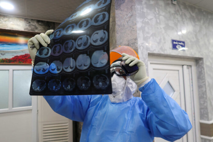 Iraqi doctor Haidar Ali Musa al-Hasani wears a protective suit as he checks a radiograph of the lungs of a man infected with the coronavirus disease (COVID-19), at the quarantine ward at Al-Hakim Hospital in the holy city of Najaf