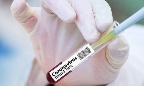 Κορονοϊός – Εμβόλιο Οξφόρδης: Ευχάριστα νέα! Δείτε πότε θα είναι έτοιμο