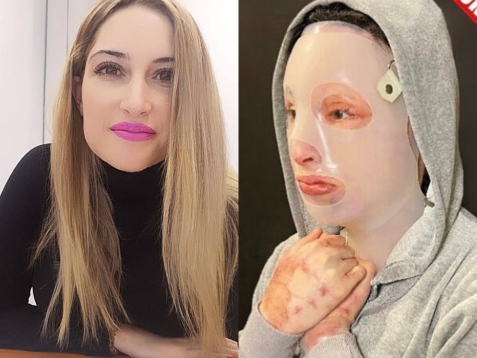 Επίθεση με βιτριόλι: Συγκλονίζει η Ιωάννα απαντώντας στην 35χρονη