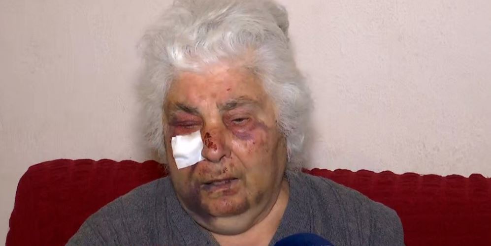 Αδίστακτοι ληστές επιτέθηκαν σε ηλικιωμένη – «Θα με σκότωναν»