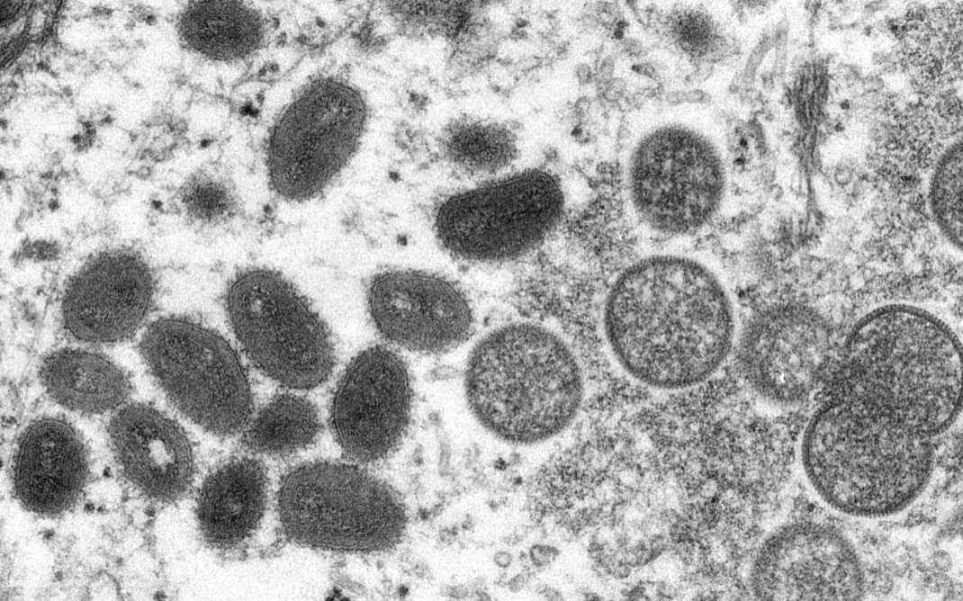 Ευλογιά των πιθήκων: «Καμπανάκι» του ΠΟΥ – «Ο ιός θα εξαπλωθεί στην Ευρώπη το καλοκαίρι»
