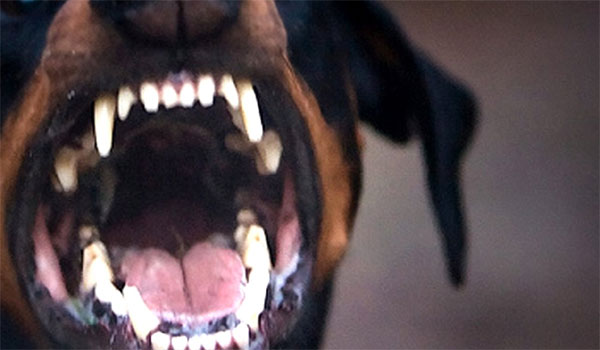 Τρόμος για άνδρα στην Χαλκίδα – Τον δάγκωσε σκύλος την ώρα που περπατούσε