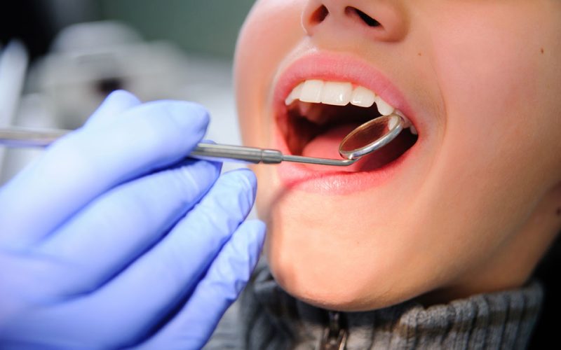 Dentist Pass στο vouchers.gov.gr: Ποια ΑΦΜ κάνουν σήμερα αίτηση – Βήμα-βήμα η διαδικασία
