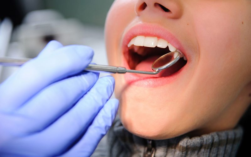 Πρόγραμμα Dentist Pass: Πάνω από 86.000 αιτήσεις