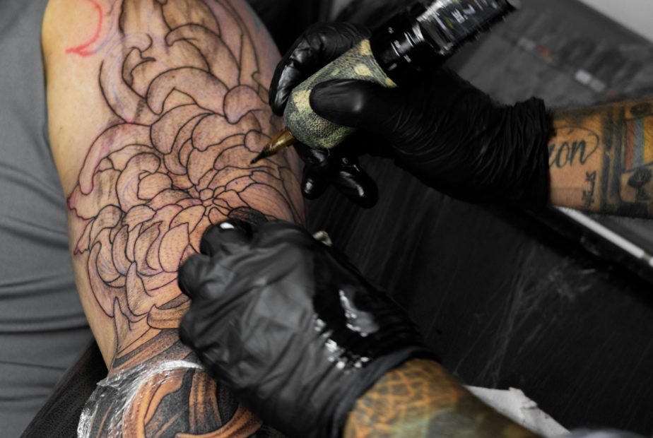 Αφαίρεση τατουάζ με laser: Πονάει τελικά και τι ακριβώς να περιμένεις;