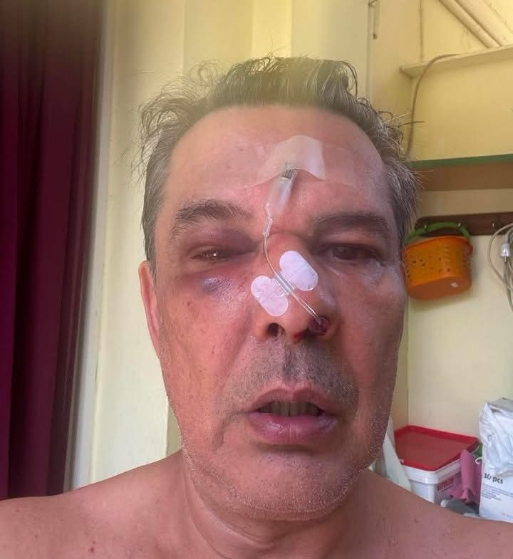 Χαϊδάρι: Άνδρας ξυλοκοπήθηκε άγρια μέσα σε ιατρείο – Δείτε τον λόγο του σοκαριστικού περιστατικού