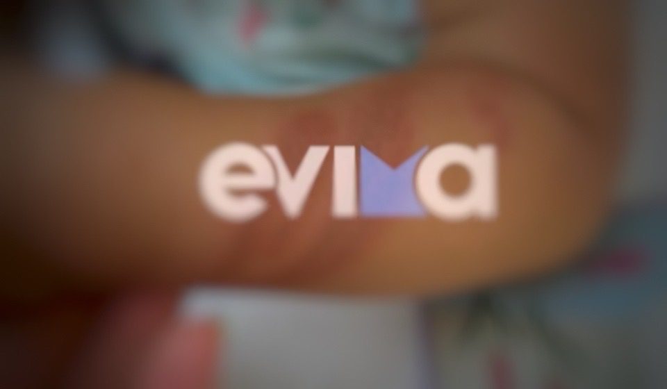 Μέδουσα τσίμπησε παιδάκι 17 μηνών στην Εύβοια: Συγκλονίζουν οι εικόνες